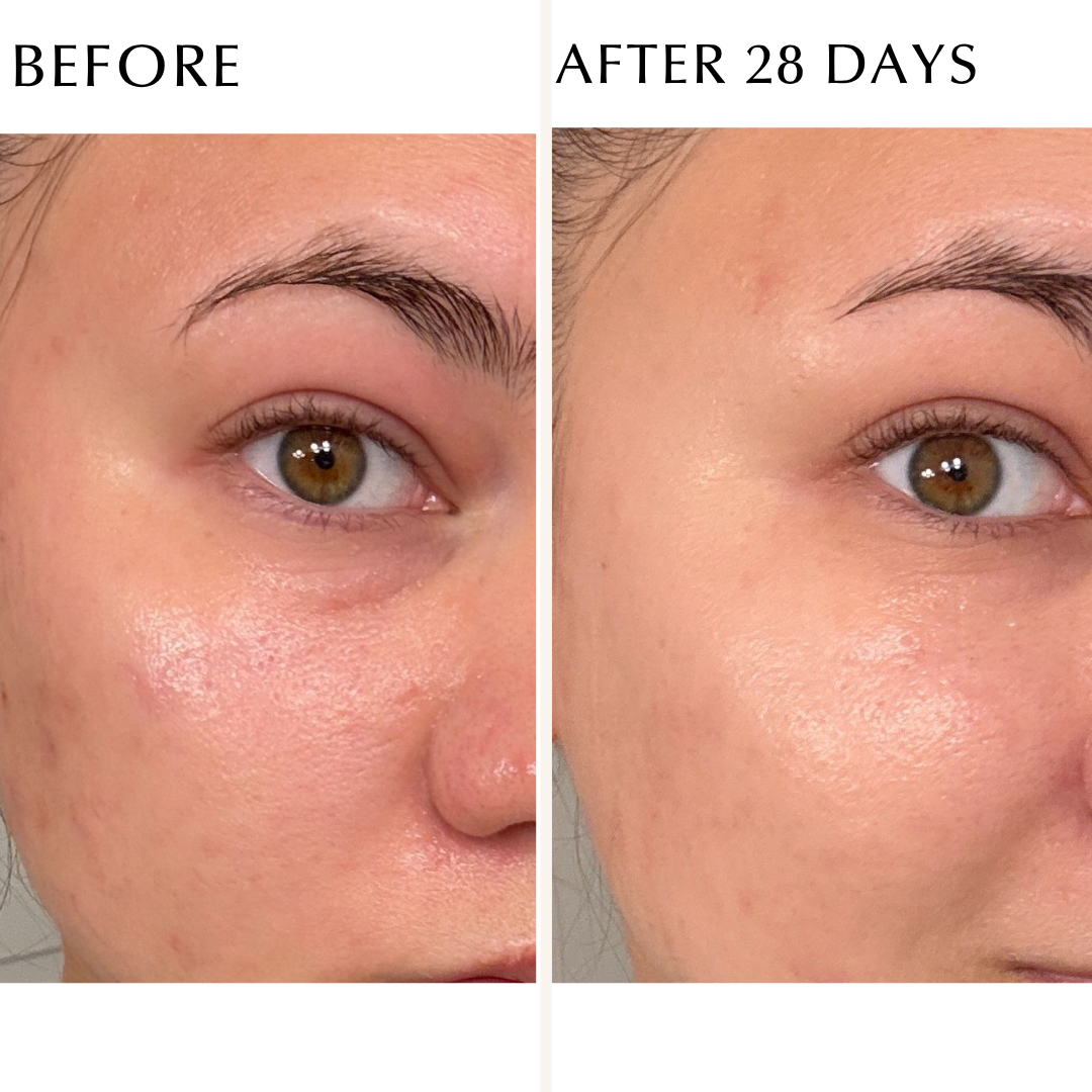 EXCIA Brightening Immaculate Serum Z – Albion Garden EXCIA Brightening Immaculate Serum Z – Albion Garden