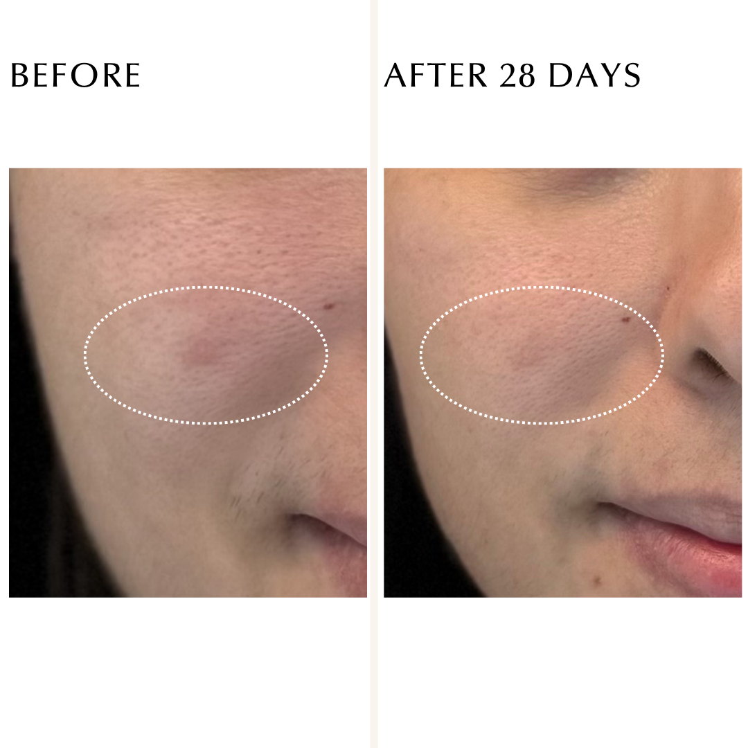 EXCIA BRIGHTENING IMMACULATE SERUM Z – Albion Garden