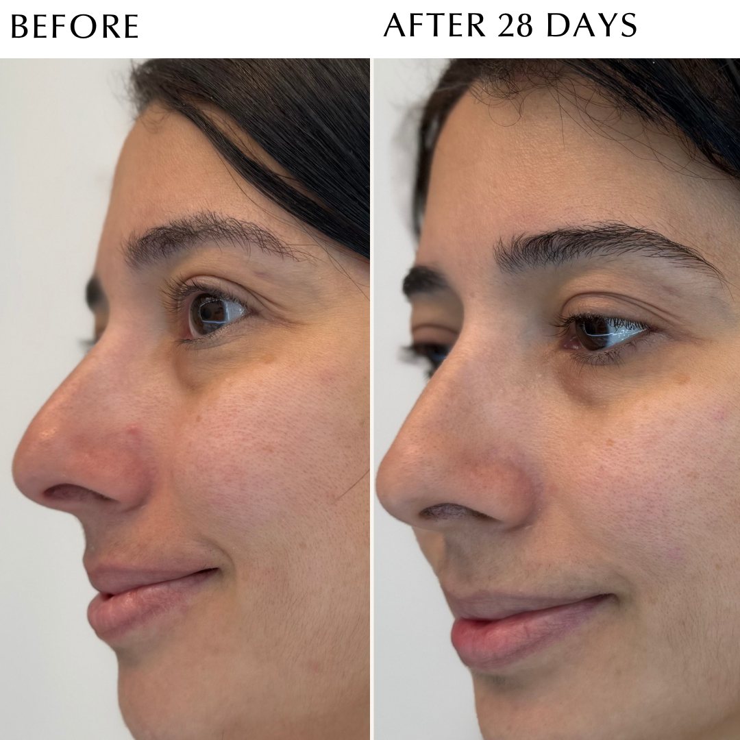 EXCIA Brightening Immaculate Serum Z – Albion Garden EXCIA Brightening Immaculate Serum Z – Albion Garden