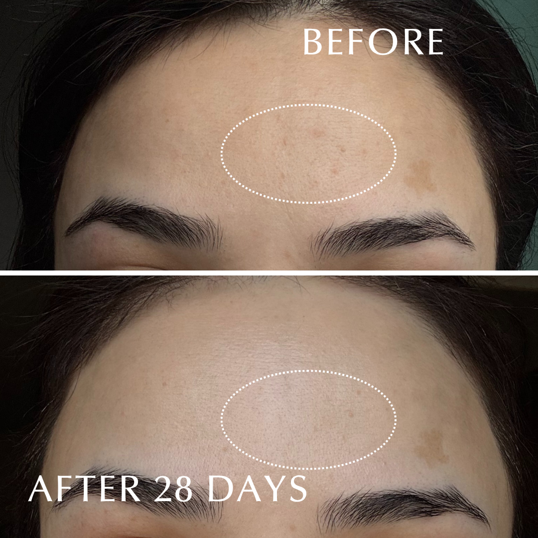 EXCIA BRIGHTENING IMMACULATE SERUM Z – Albion Garden