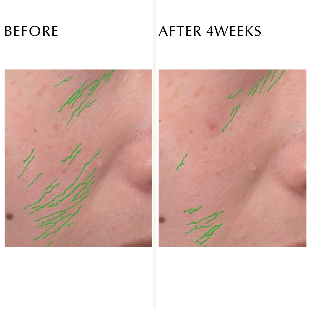 EXCIA DOUBLE KEY ADVANCE SERUM