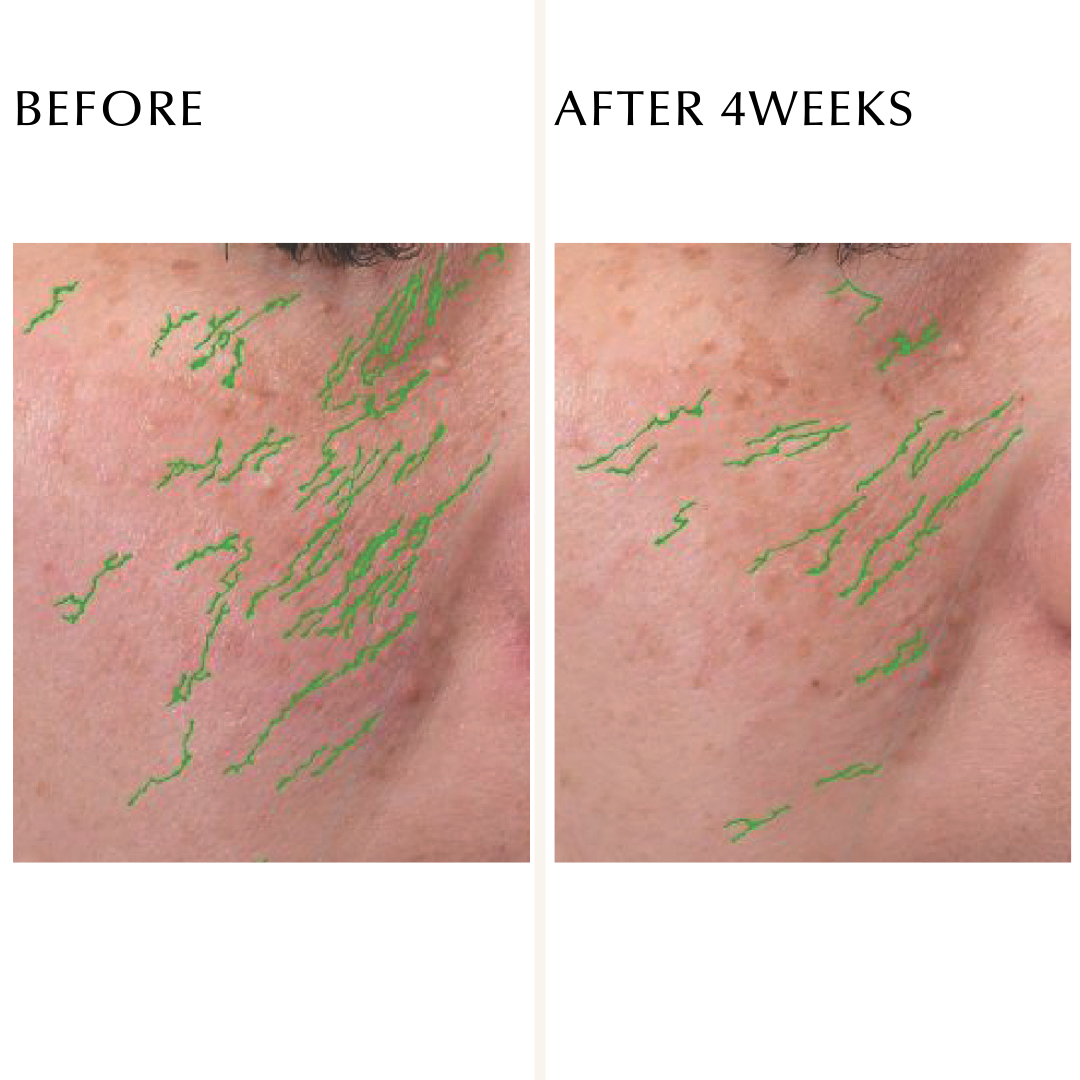 EXCIA DOUBLE KEY ADVANCE SERUM